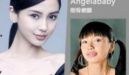 西安整容爆料案件最新,揭开医美行业潜规则与患者权益受损之谜